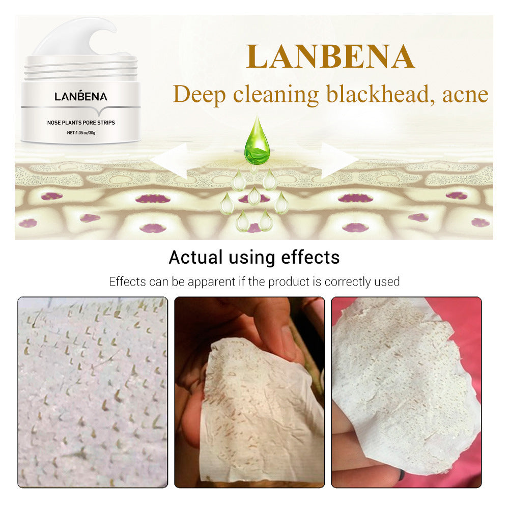 Blackhead Remover Mask - Membrane Sucking Blackhead Tearing To Remove Acne